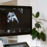 Sikiöt altistuvat muoville jo kohdussa- Tutkijat löysivät mikromuovia jokaisesta tutkitusta istukasta