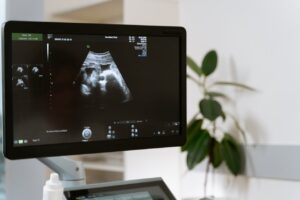 Read more about the article Sikiöt altistuvat muoville jo kohdussa- Tutkijat löysivät mikromuovia jokaisesta tutkitusta istukasta